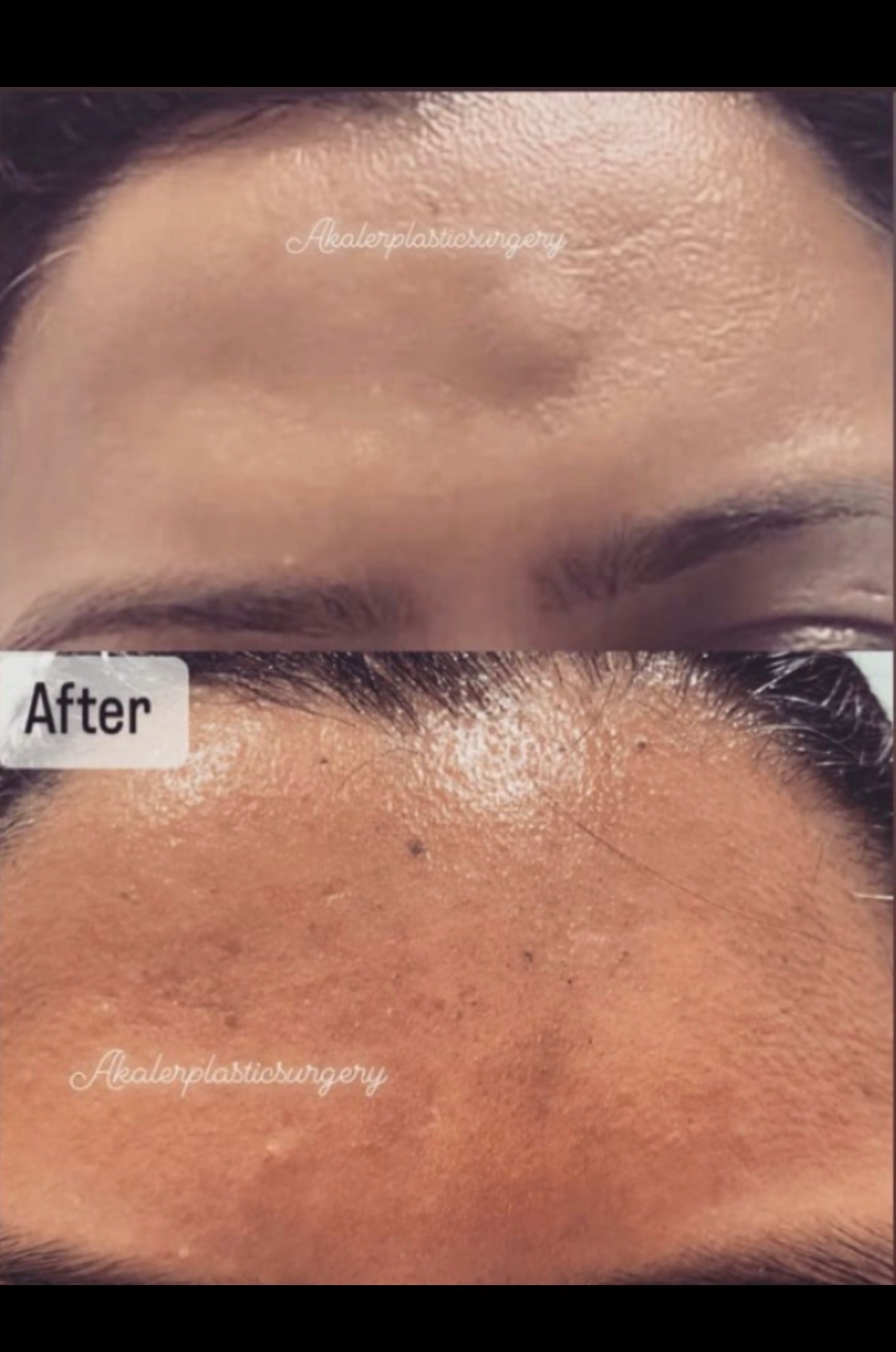 Before and after
