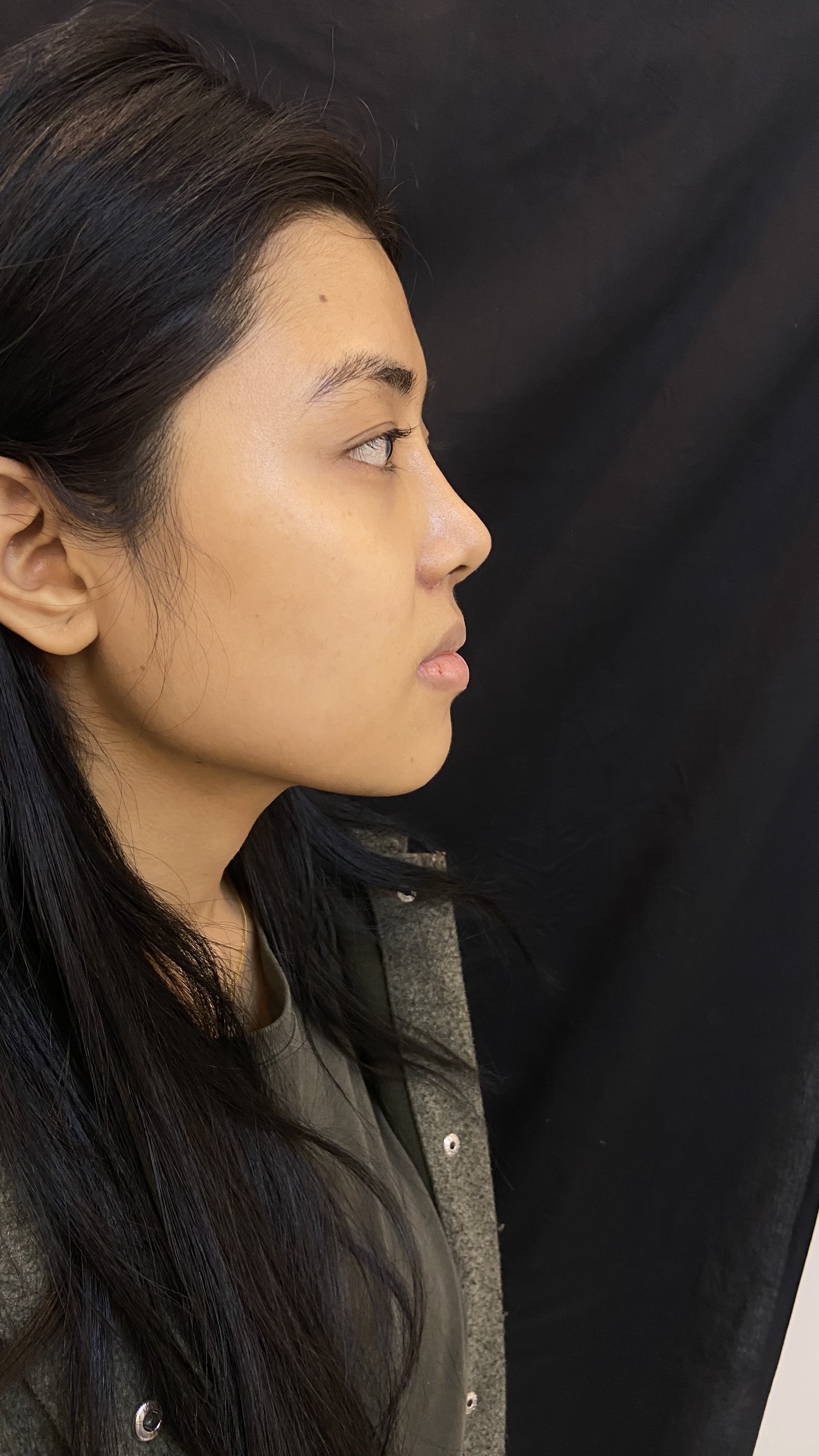 An average natural looking indian nose