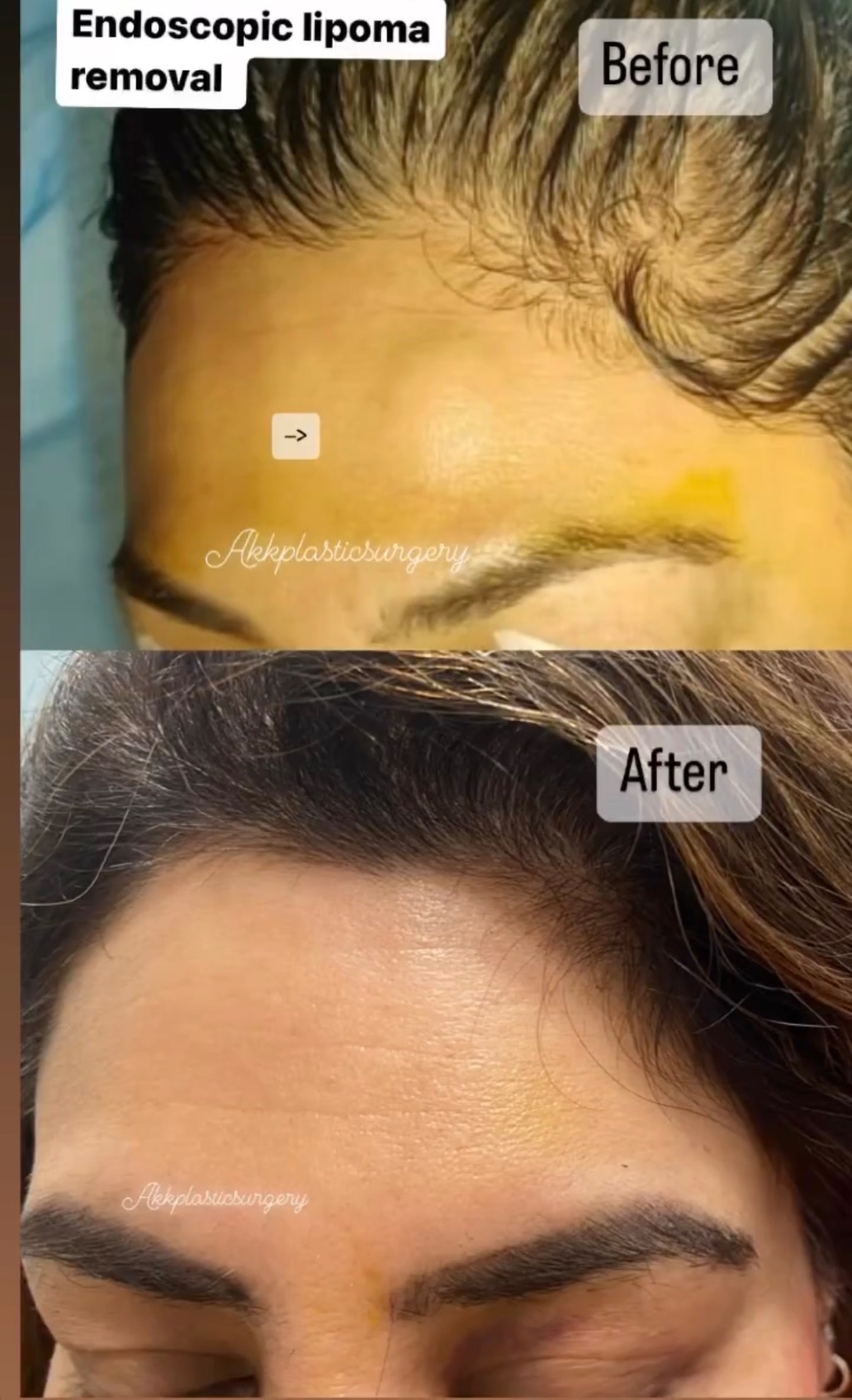 Before and after 