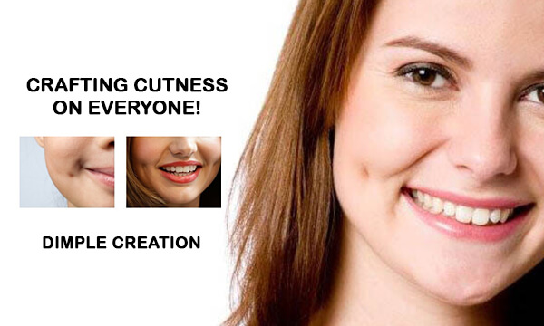 Dimpleplasty Procedure