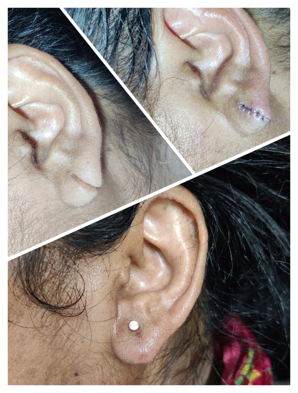 repair and repiercing