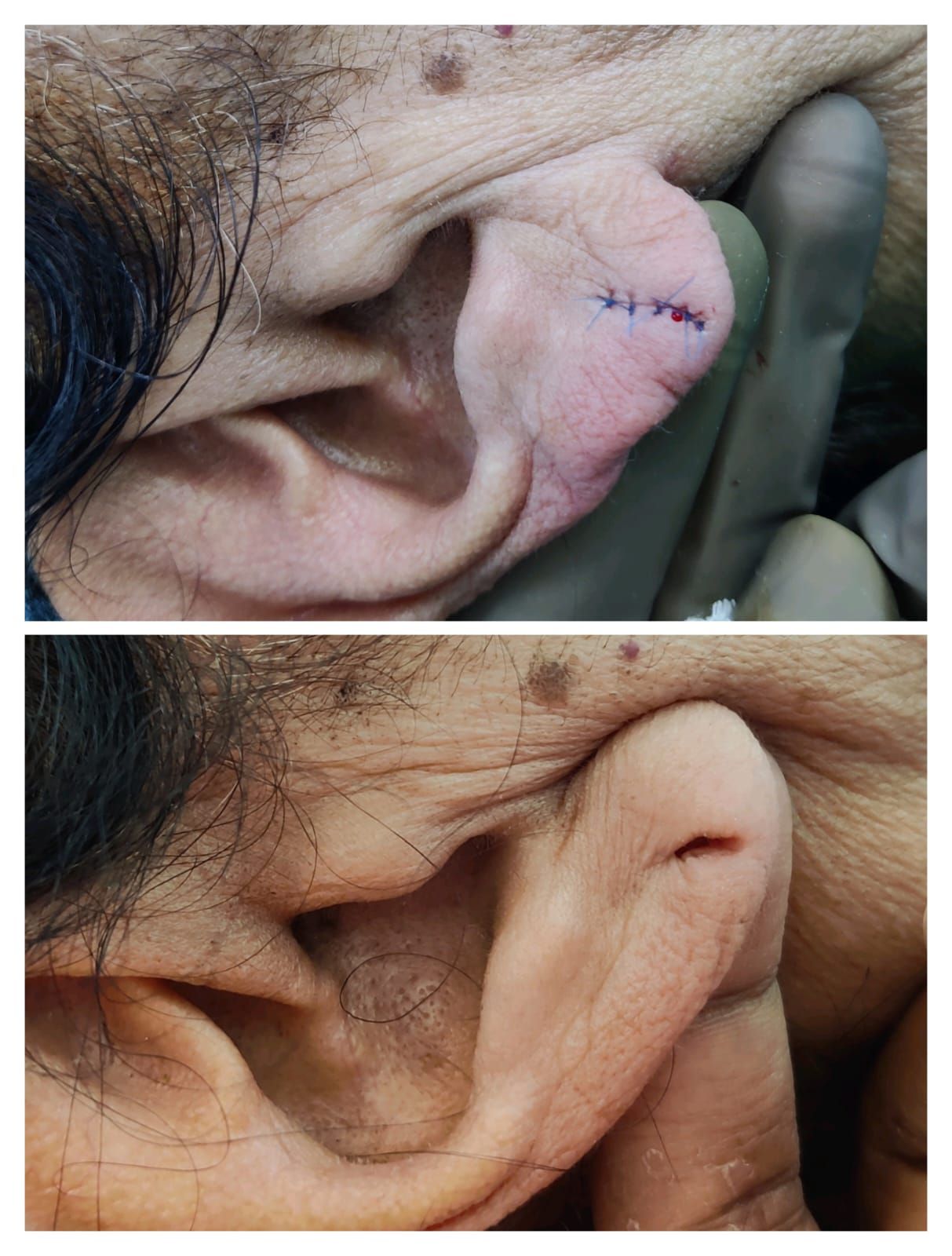 before and after (rotate this picture)