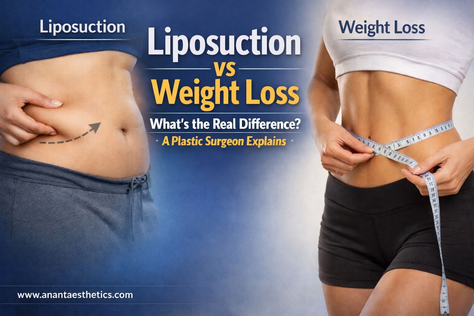 Liposuction vs Weight Loss