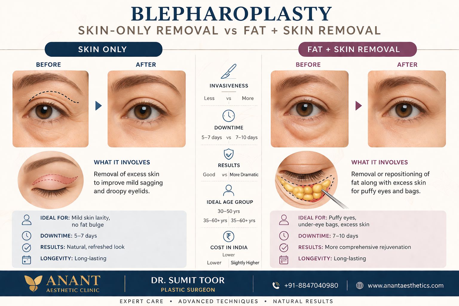 Blepharoplasty