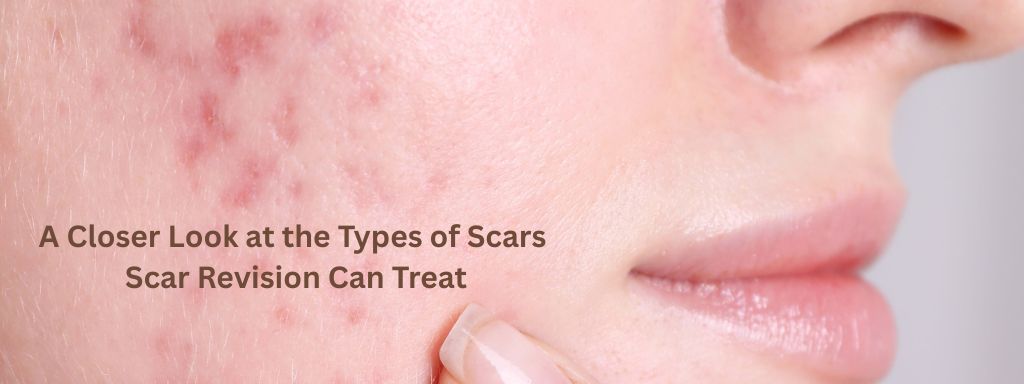 Closer Look at the Types of Scars