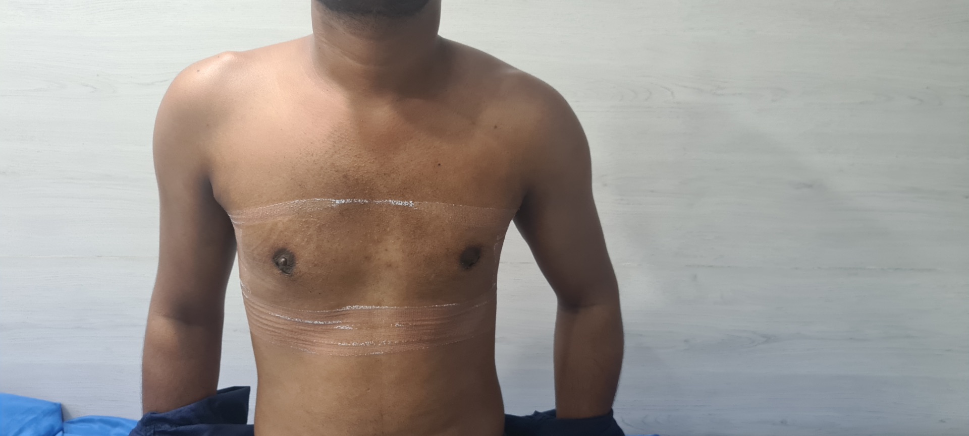 See immediate results on day 2