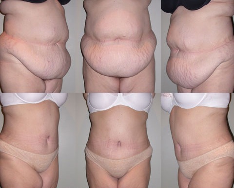 Mother of 3 kids regained her shape 