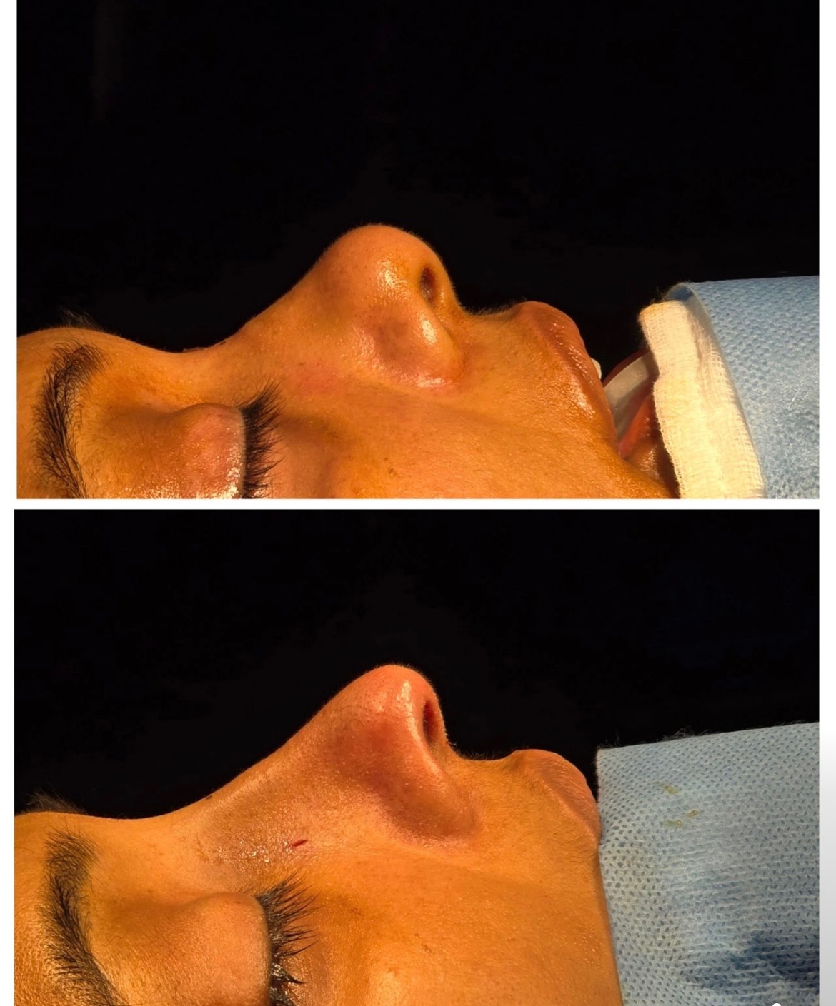 See the immediate results in operation theatre 