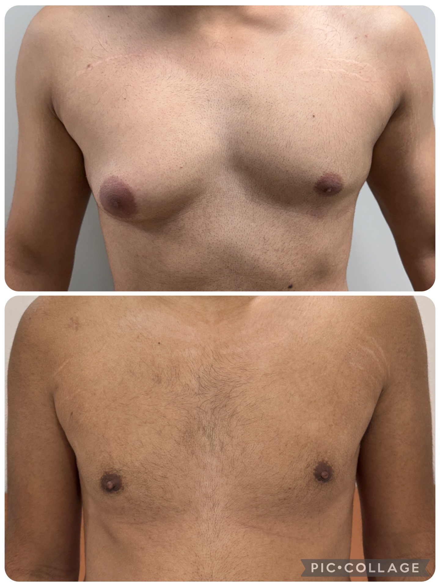 Surgery can give symmetry 