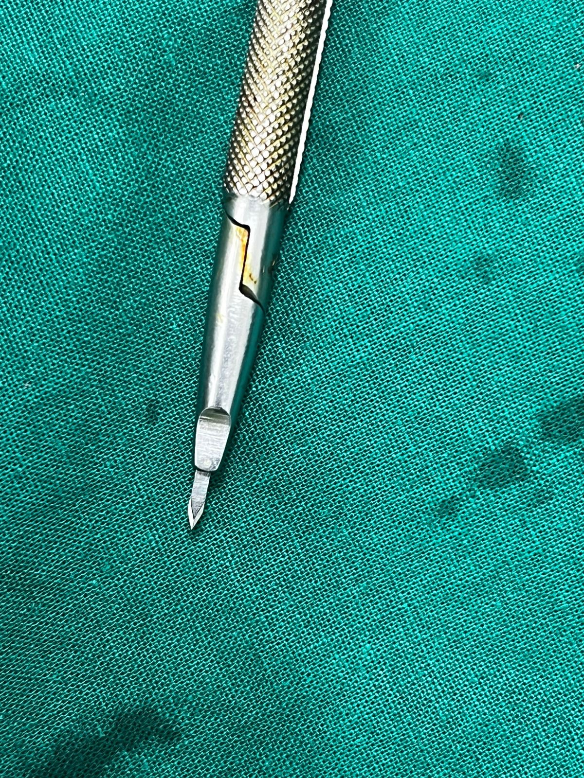 Where to do Hair Transplant?