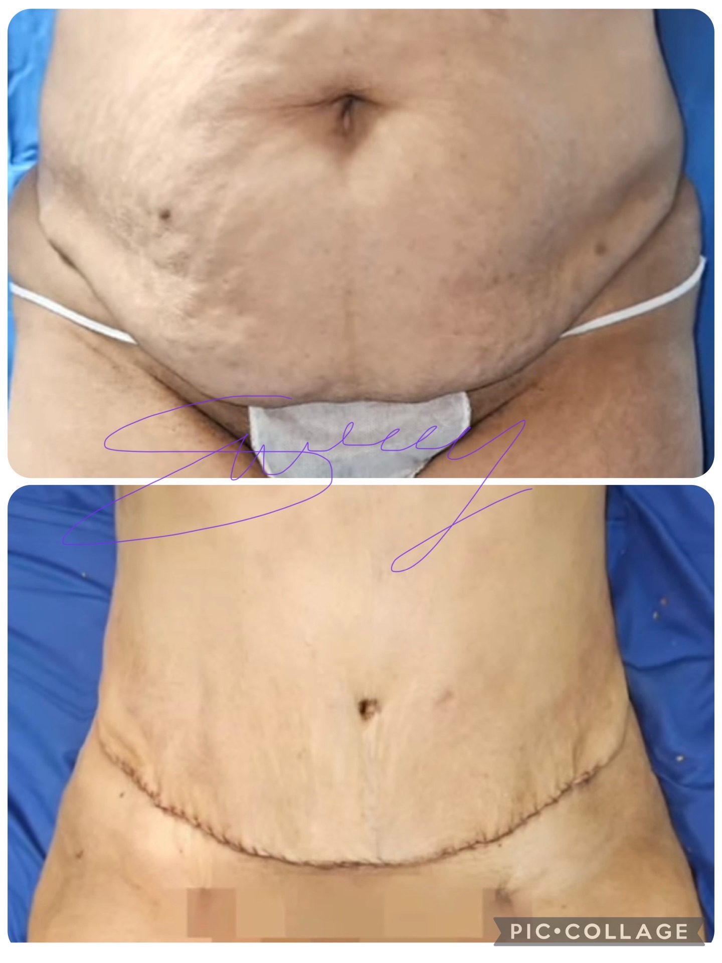 See the shape and hidden scars