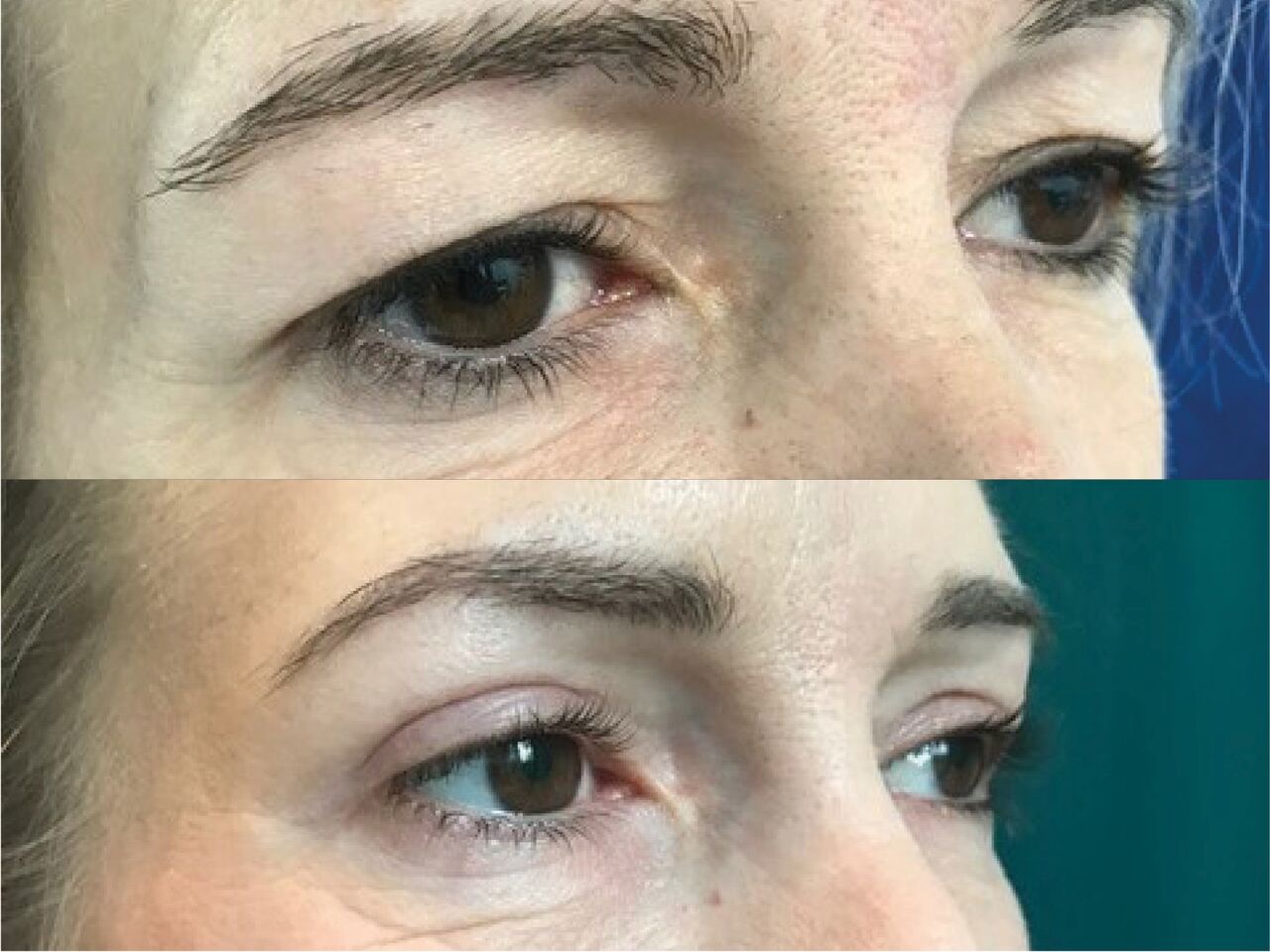 Patient looks immediately younger in age 