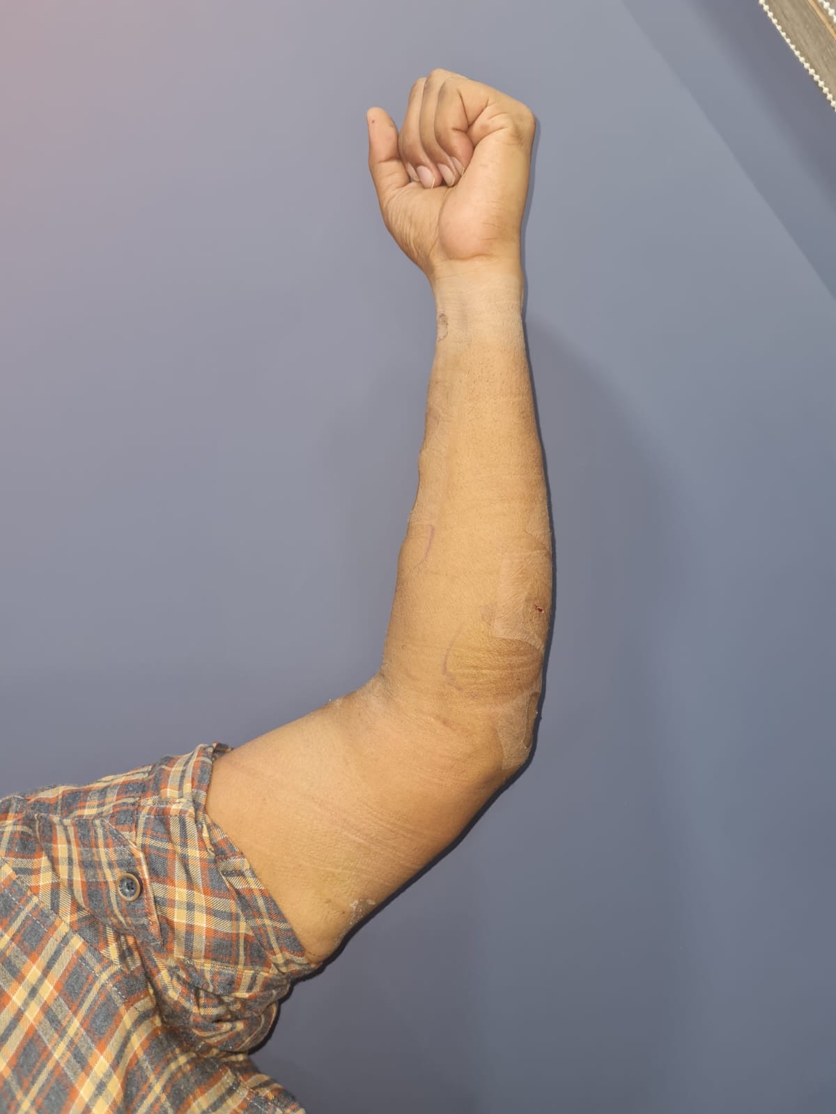 See the results with minimal incisions and no scars 