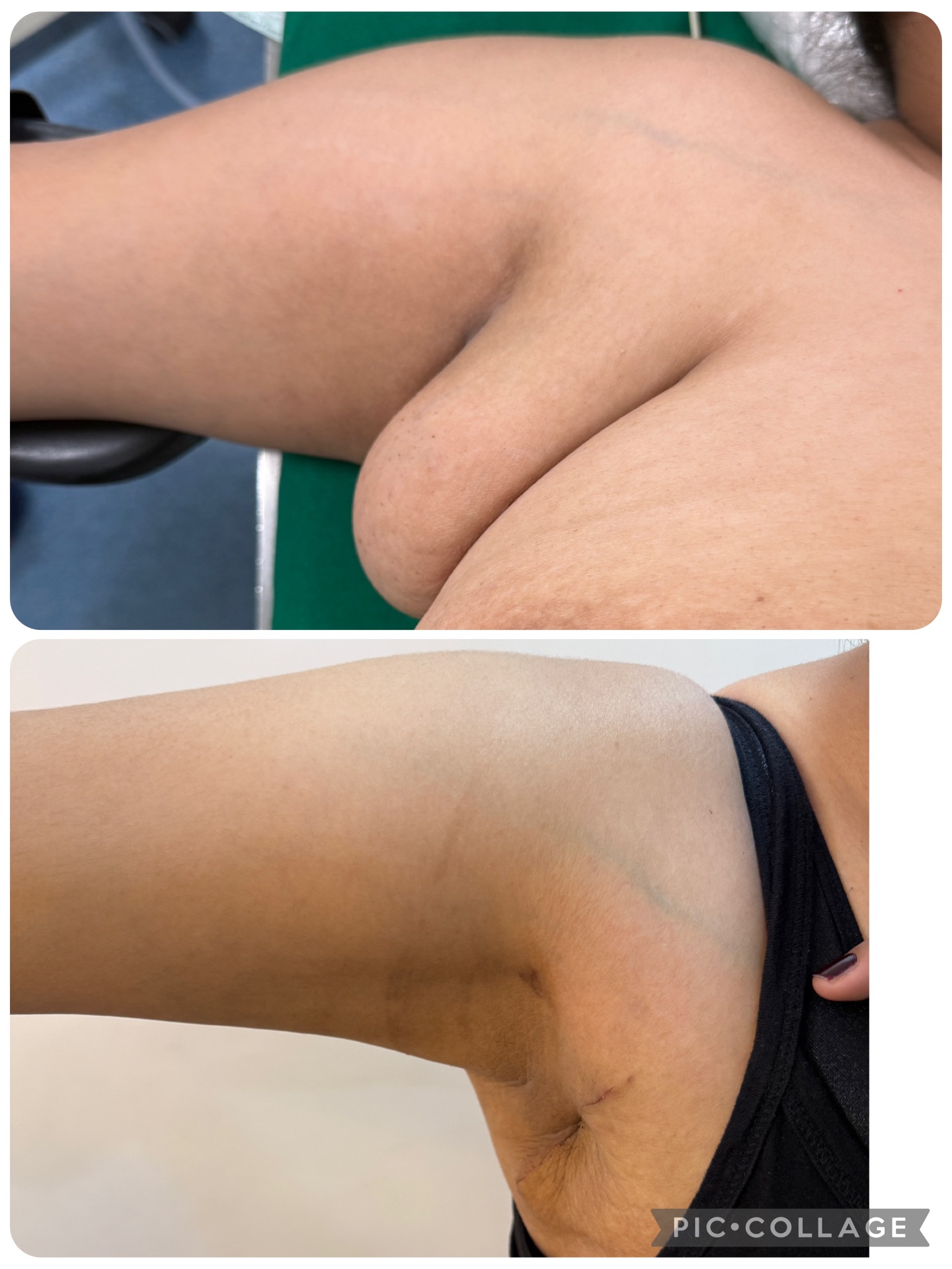 See the difference with day care surgery