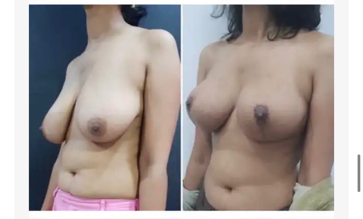 See the results and change