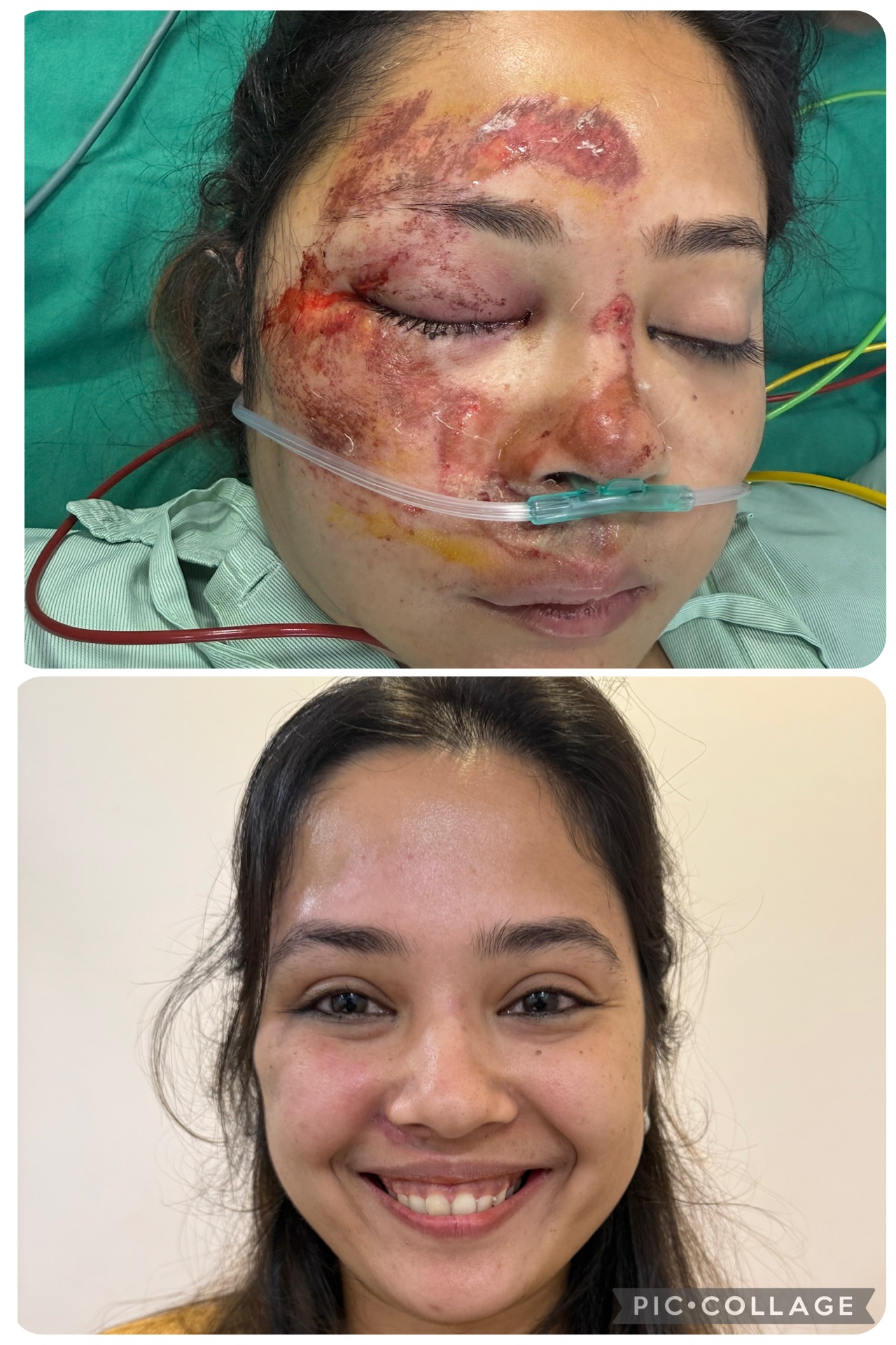 Plastic Surgeon Suturing