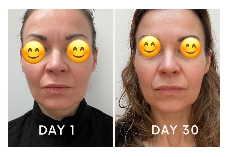 See the difference in skin quality 