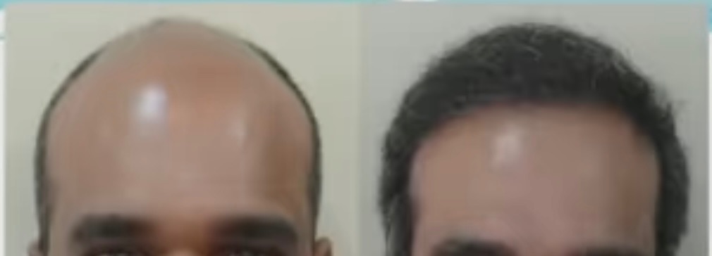 See the results of a young male 