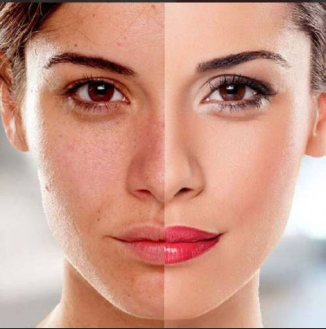 This image is a split-face comparison of the same woman, used to highlight the contrast between natural skin texture and cosmetically altered or “perfected” skin.