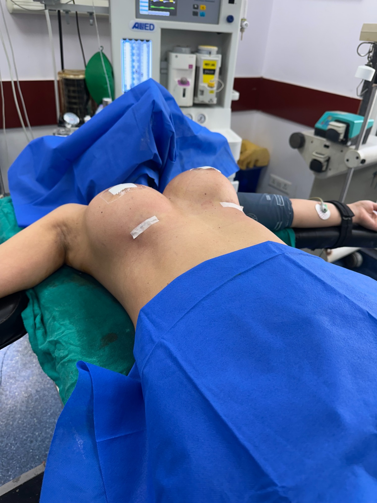 after picture while lying down