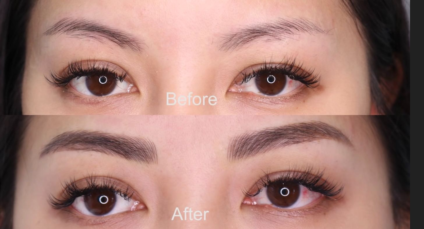 before and after 