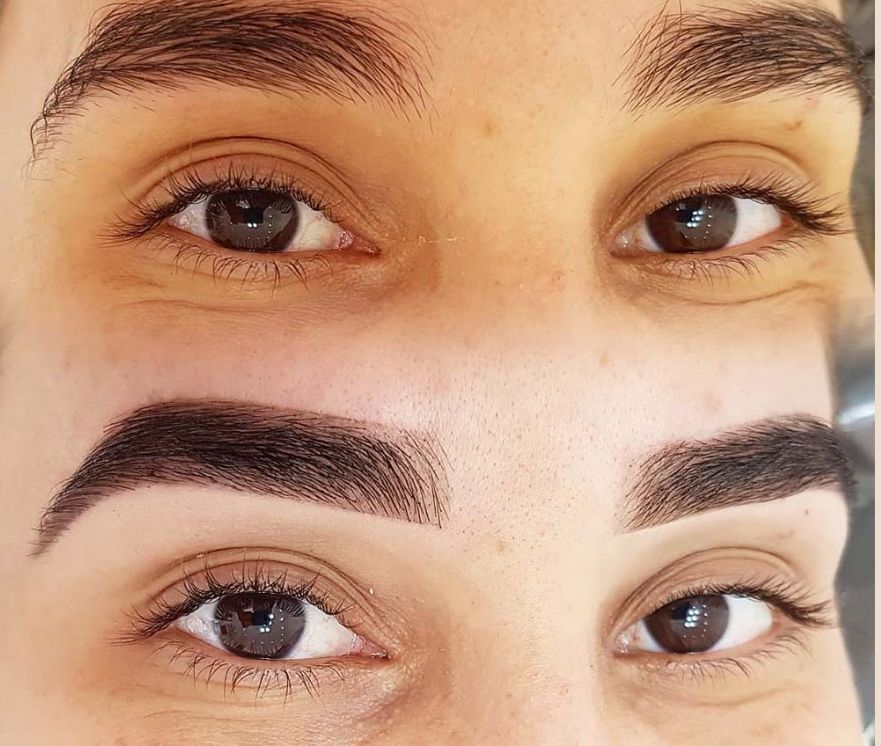 before and after