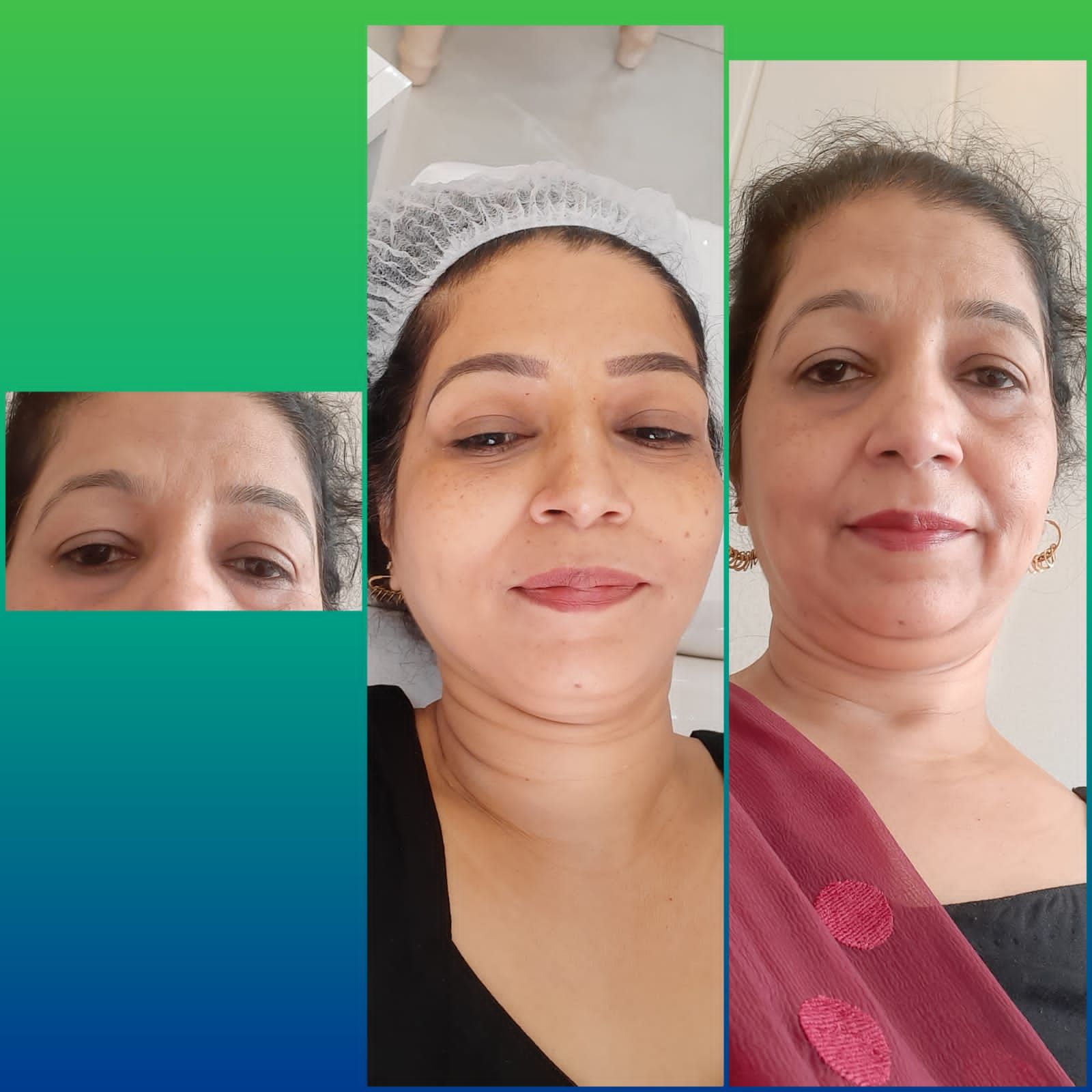 before (right and left), after (centre)